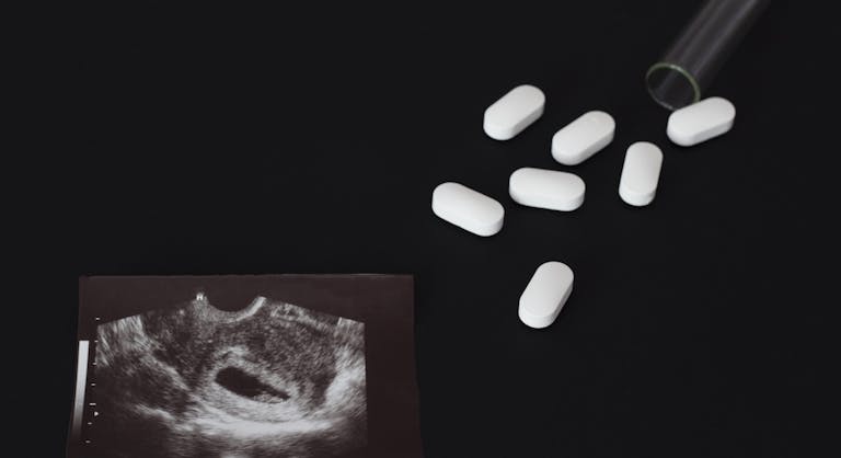abortion, ireland, abortion pils, abortion pill, south carolina