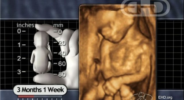 13 weeks post-fertilization, 15 weeks LMP Arizona Supreme Court upholds law protecting most preborn children from abortion image
