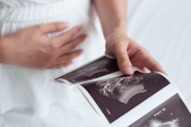 pro-lifers, pregnant, Texas, CareNet, abortion pill reversal, preborn children, poll