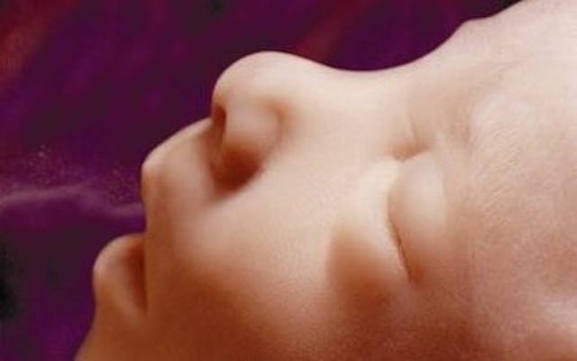 Face of preborn baby at 16 weeks WATCH: Theresa was pressured into an abortion she never wanted image