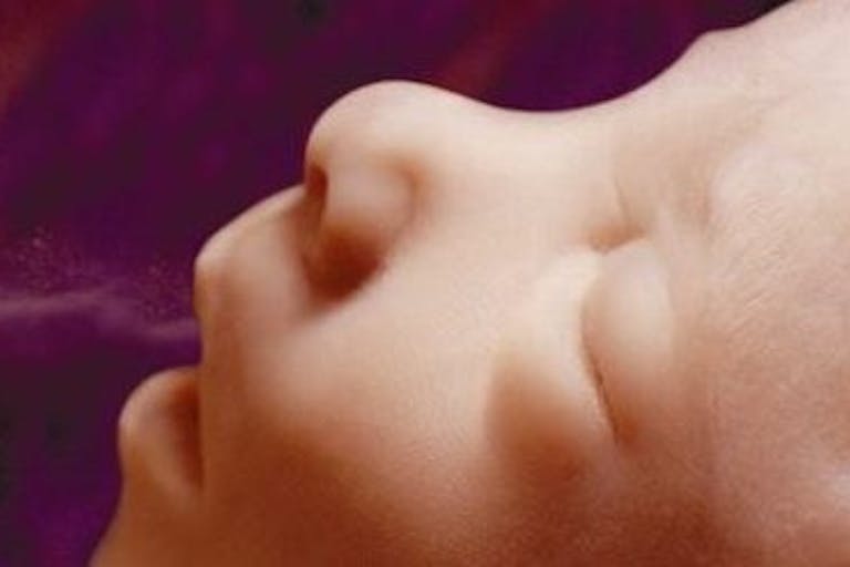 Face of preborn baby at 16 weeks WATCH: Theresa was pressured into an abortion she never wanted image