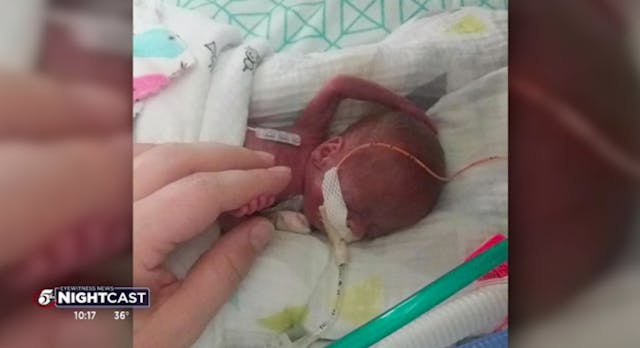 Screenshot: Richard Hutchinson at 21 weeks Outrageous abortionist Warren Hern thinks lethally injecting a child in utero is not an abortion image