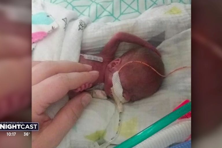 Screenshot: Richard Hutchinson at 21 weeks Outrageous abortionist Warren Hern thinks lethally injecting a child in utero is not an abortion image