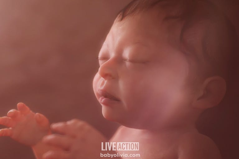 Baby Olivia – 20 weeks after fertilization, 22 weeks LMP/gestation Baby Olivia