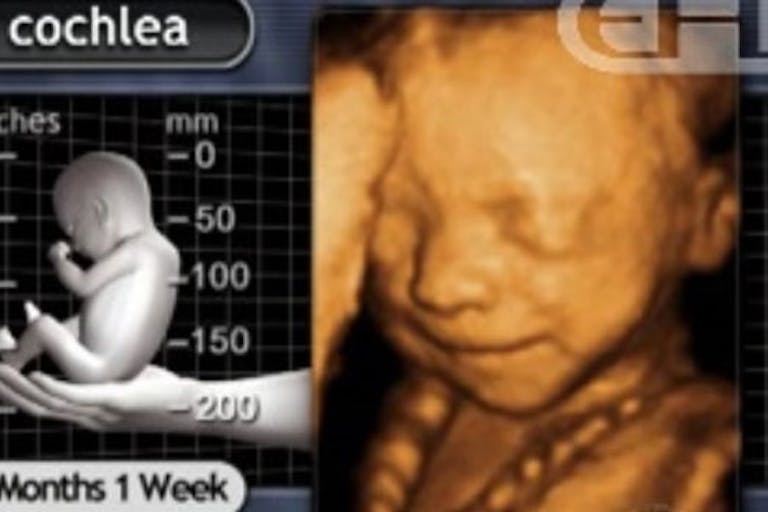 21 weeks After Supreme Court loss, Planned Parenthood halts abortions in Arkansas image