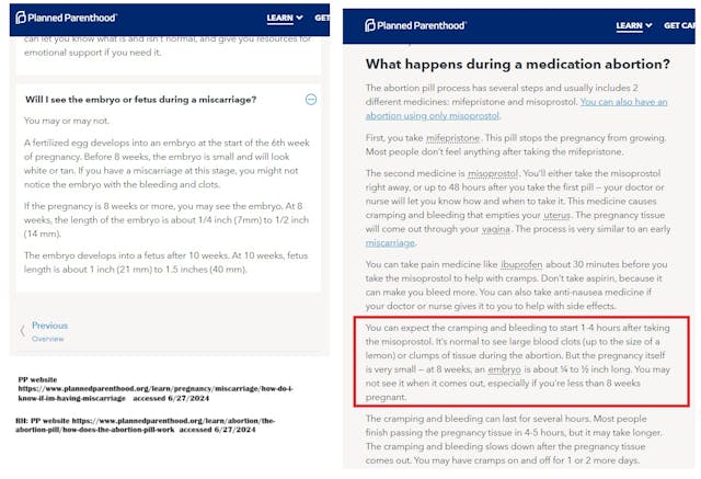 Planned Parenthood deceptive description of seeing the baby or embryo miscarriage v abortion pill Planned Parenthood deceptive description of seeing the baby or embryo miscarriage v abortion pill