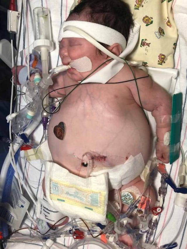 Michael as an infant (courtesy of Tricia Borg) Michael as an infant (courtesy of Tricia Borg)