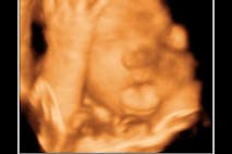 Fetus Facepalm