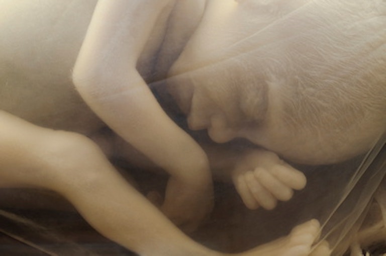 doctors, abortion, abortions