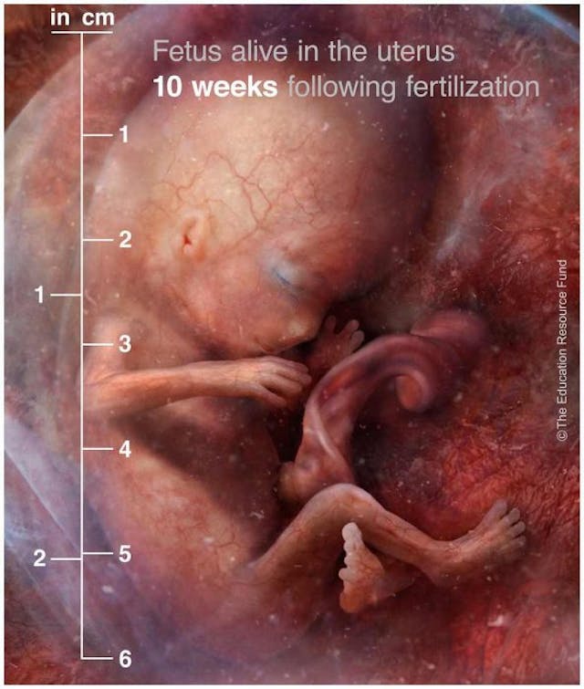 10 weeks post-fertilization (12 weeks gestation/LMP) First trimester babies aren’t blobs of tissue — they’re amazingly complex image