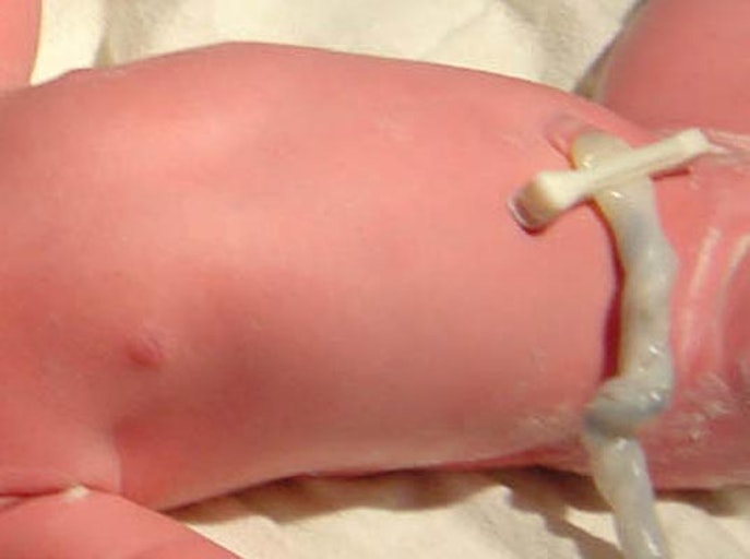 Umbilical Cord