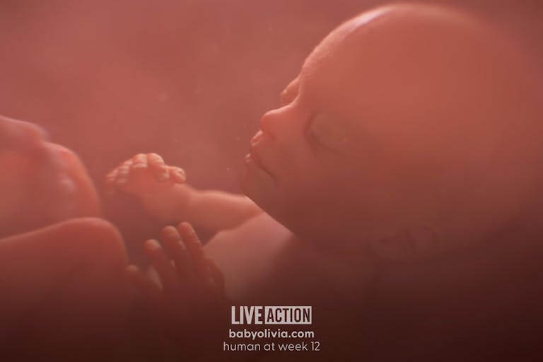 Baby Olivia, abortion, Live Action