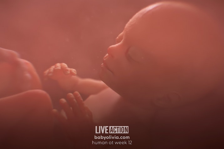 Baby Olivia, abortion, Live Action