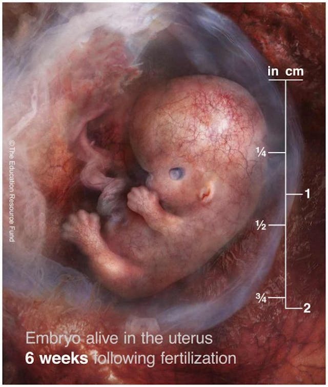 6 weeks from fertilization (8 weeks gestation/LMP) First trimester babies aren’t blobs of tissue — they’re amazingly complex image