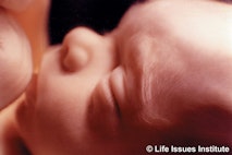 abortions,abortion, late-term, aborted, baby olivia, viability