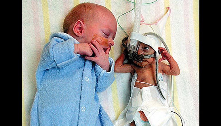 preemies