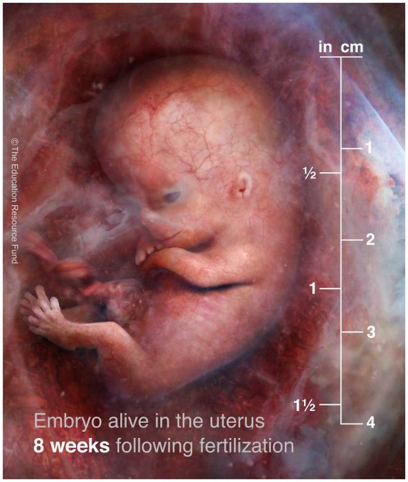 First trimester babies aren’t blobs of tissue — they’re amazingly complex image