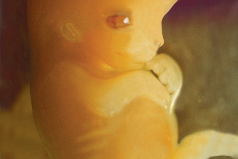 7-weeks-human-fetus