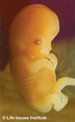 7-weeks-human-fetus