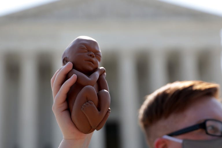 abortion, pro-life