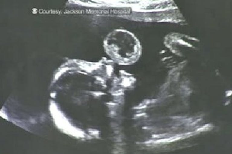 lyna_gonzalez_mouth_tumor_xray