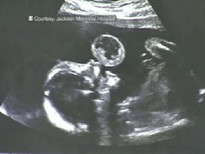 lyna_gonzalez_mouth_tumor_xray
