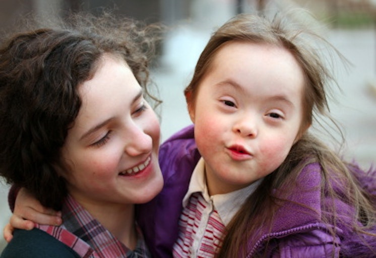 down-syndrome-child-girl