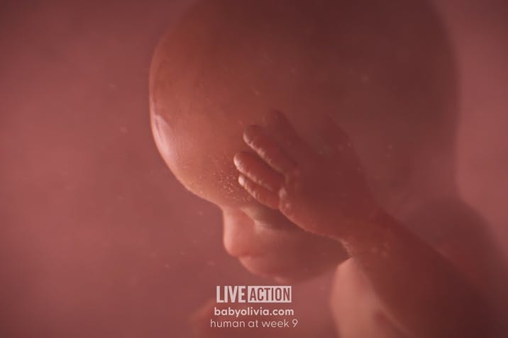 Baby Olivia, pro-life