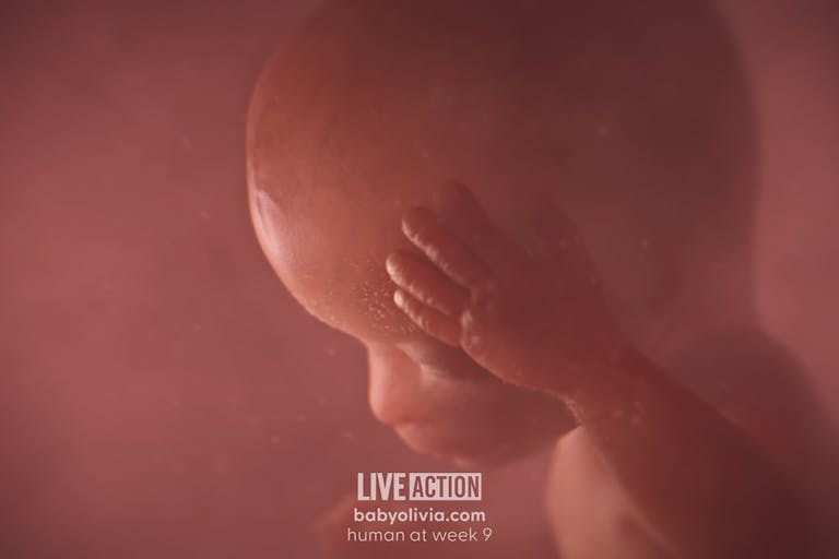 Baby Olivia, pro-life