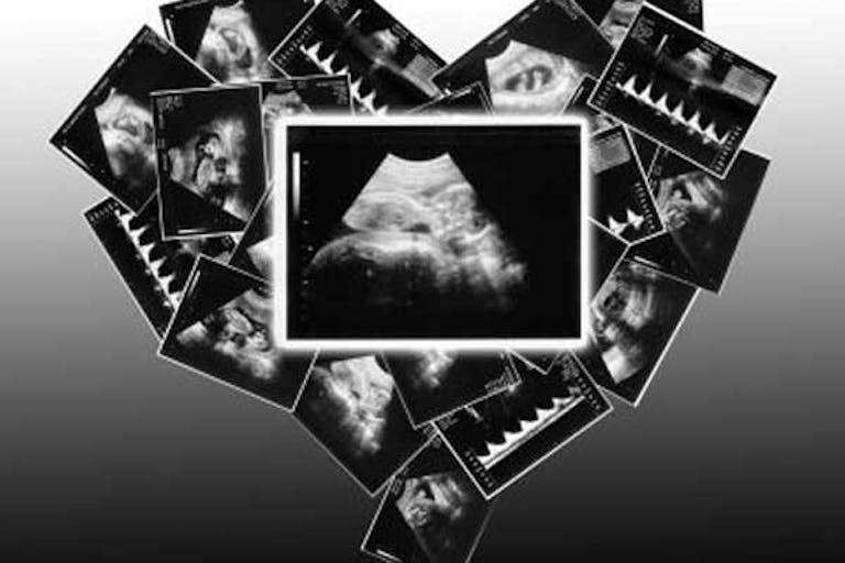 song, heartbeat, abortion