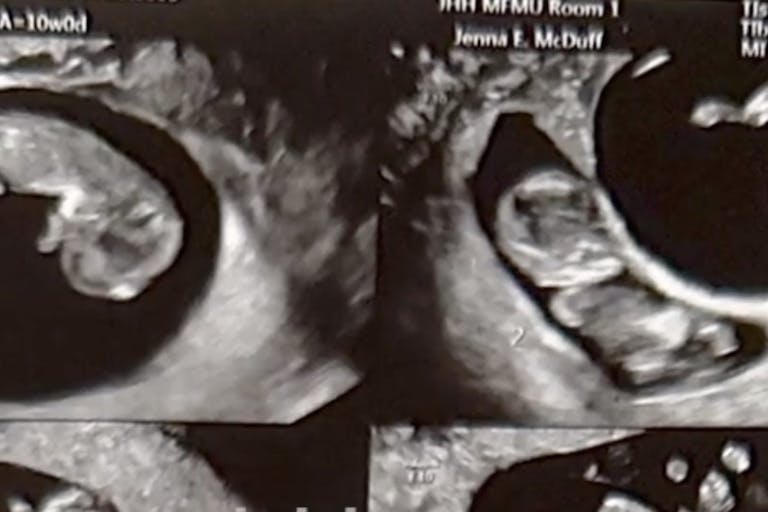 screenshot quadruplets Ebony Apps