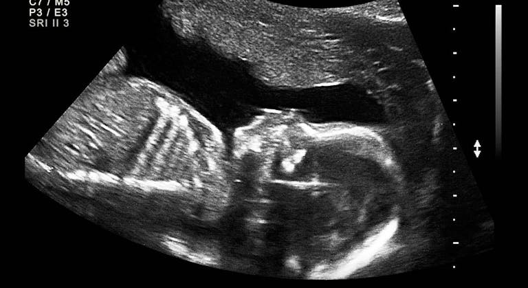 Planned Parenthood, abortion reporting, abortion
