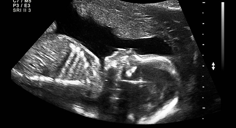 Planned Parenthood, abortion reporting, abortion