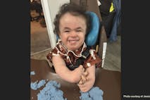 andrew morales trisomy 18