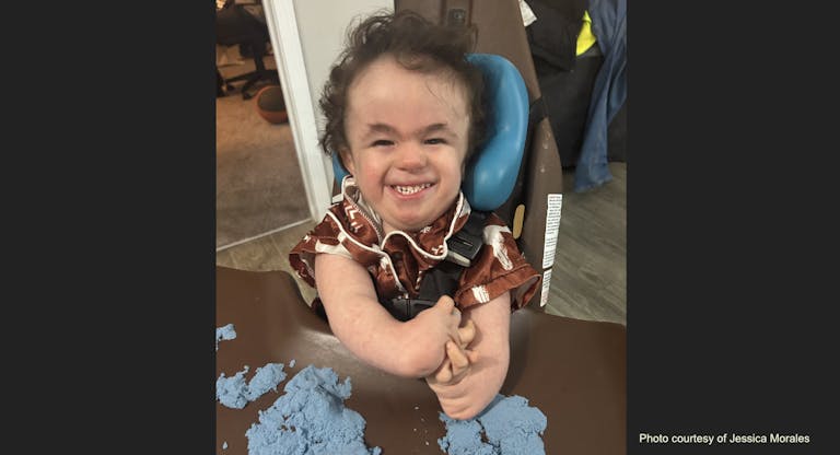 andrew morales trisomy 18