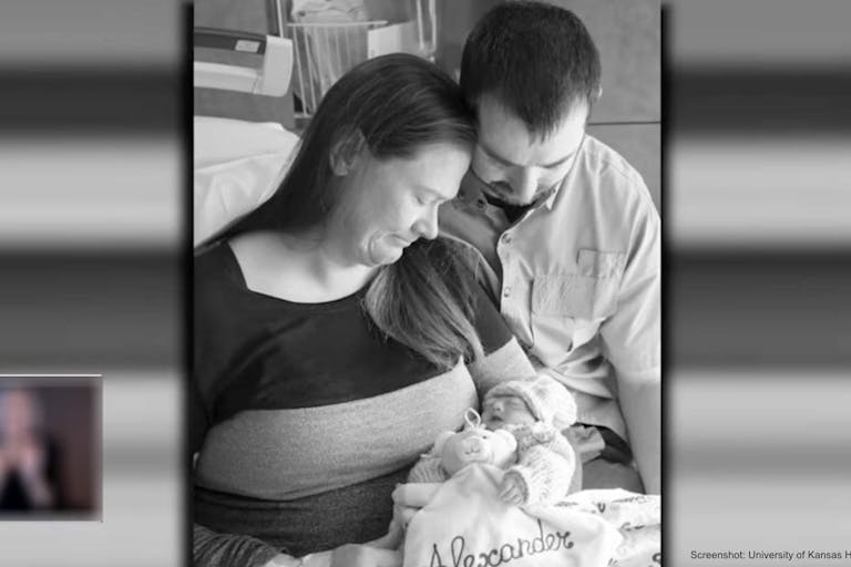 Abraham and Christine Jacobs baby Alexander anencephaly