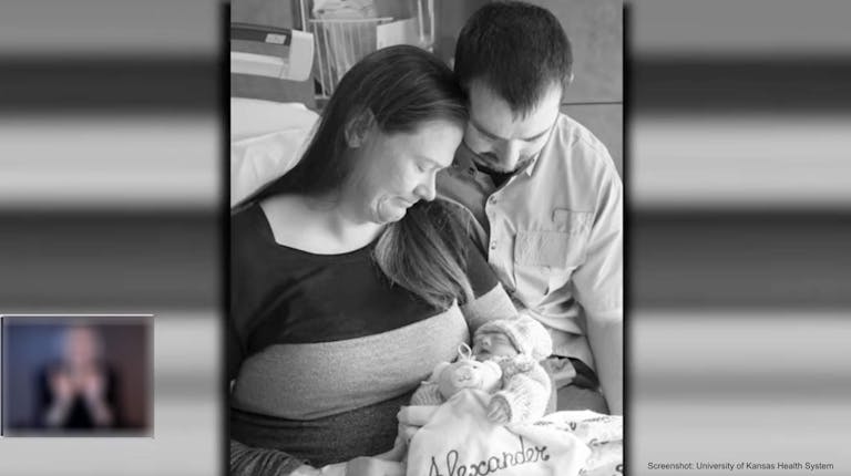 Abraham and Christine Jacobs baby Alexander anencephaly