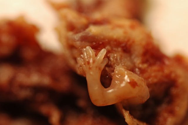 The hand and arm of aborted baby—7 weeks. (Photo courtesty of prolifesociety.com and imagesofabortion.com.) abortion, aborted