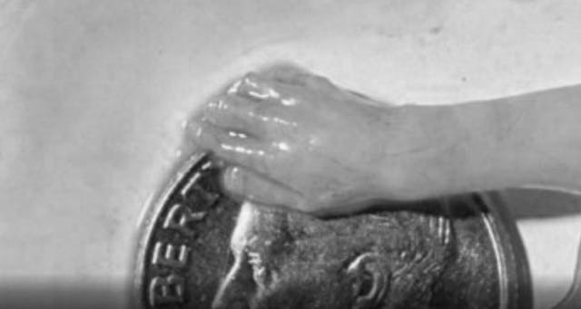 Hand of a 10-week-old aborted child.