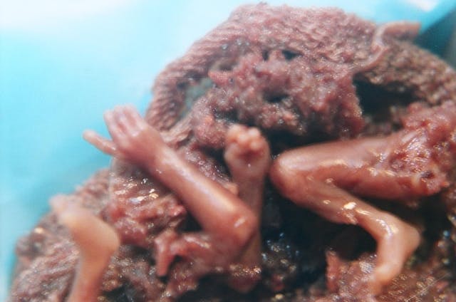 Nebraska measure would legalize abortion through birth image