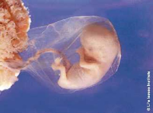 Abortion worker flees facility after seeing 16-week-old baby born alive image