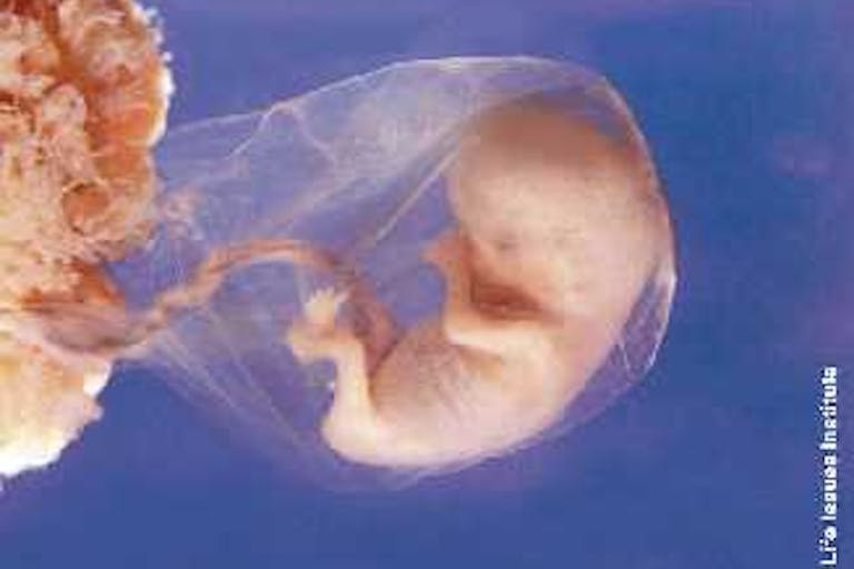 Baby at 8 weeks, in the first trimester