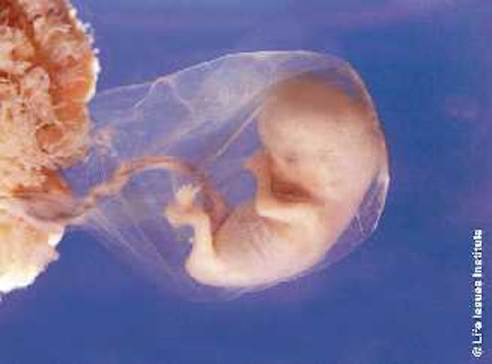 Abortion worker flees facility after seeing 16-week-old baby born alive image