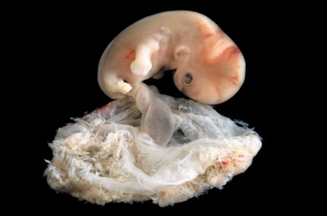 Science is clear: Each new human life begins at fertilization image