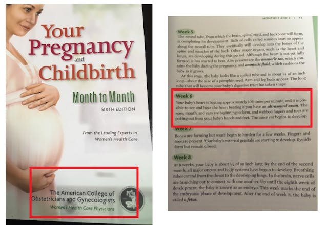 ACOG book says fetal heartbeat beating at 6 weeks