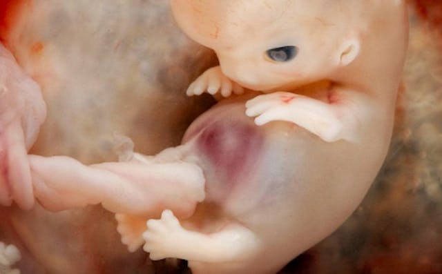 first trimester, abortion pill, 8 weeks, abortion procedures videos, heartbeat