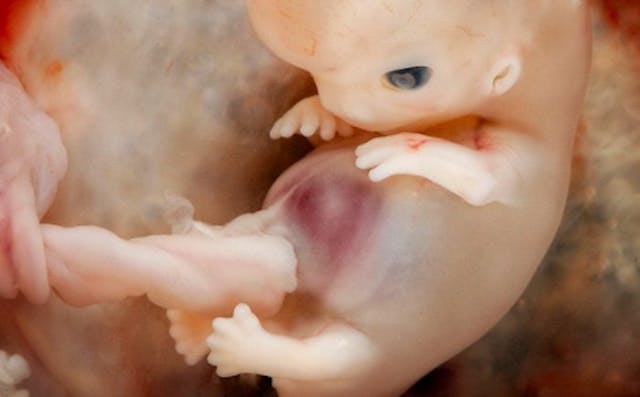 A human baby at 7-8 weeks old first trimester, abortion pill, 8 weeks, abortion procedures videos, heartbeat