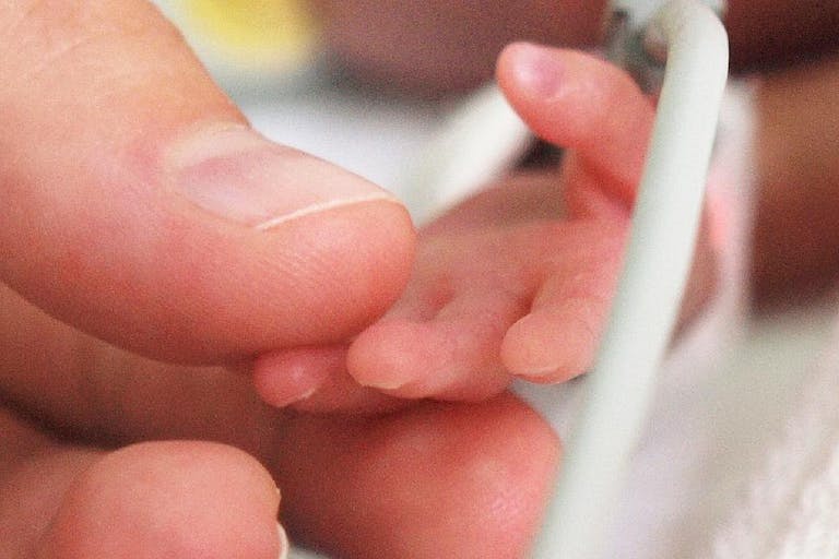 preemie, premature, abortion survivor, born alive