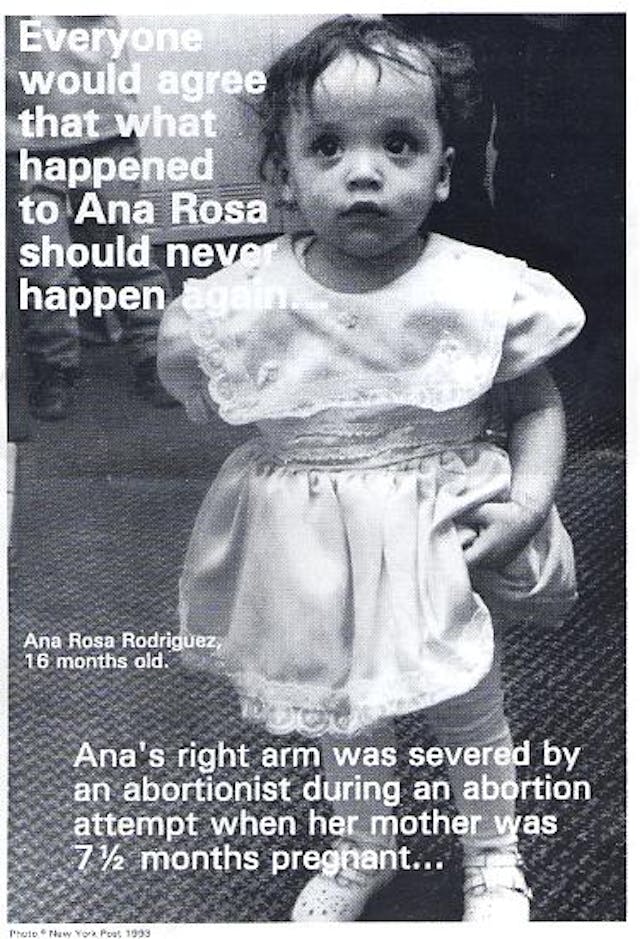 Ana Rosa Rodriguez one of many babies born alive after failed abortion attempt Ana Rosa Rodriguez one of many babies born alive after failed abortion attempt