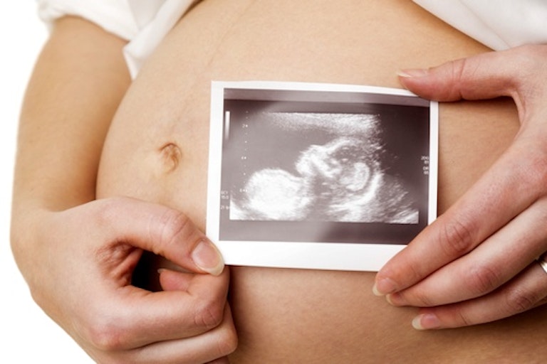 miscarriage, ultrasound, abortion
